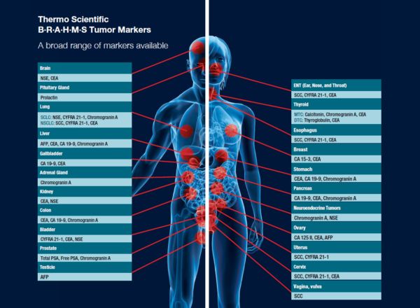 Tumor Markers